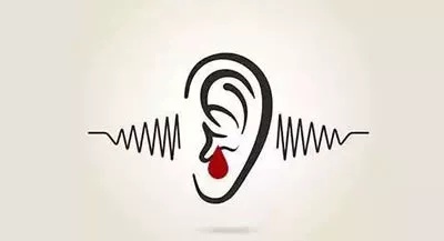 科学家发现了一种药物来避免噪音引起的听力障碍