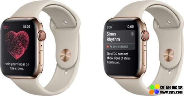 苹果 Watch Series 4 的心电图功能检测到心房纤颤，