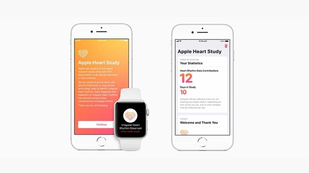 史丹福大学研究指，Apple Watch 侦测心律不整准确