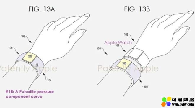 苹果申请新专利全新穿戴式血压计